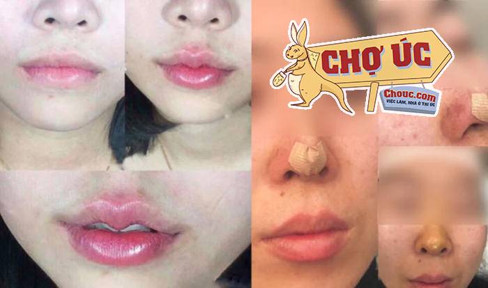 Photos of cosmetic procedures posted to Lee Kim Tan&#039;s Facebook page